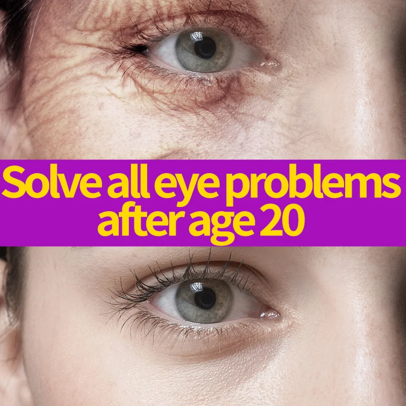 

Eye Cream to Reduce Line Smooth Under Eye Cream for Dark Circles & Puffiness Eye Bag Treatment Anti Aging Cream Fights Dullness