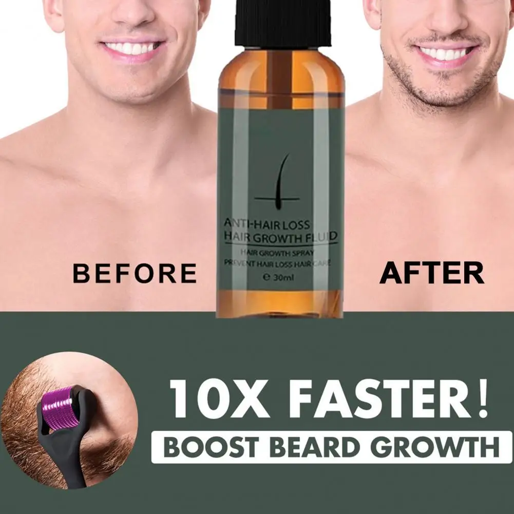 

30ml Good Hair Growth Spray Not Irritating Nourishing Hair Growth Products Hair Loss Treatments Growth Spray
