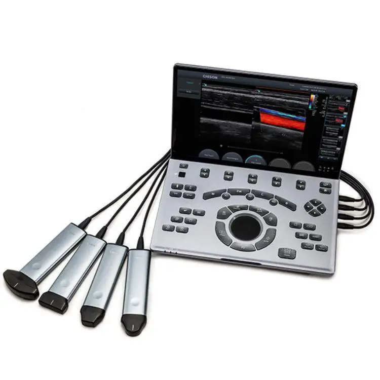 Портативный ультразвуковой аппарат Chison Sonoair 70 3d 4d сканер цветной допплер