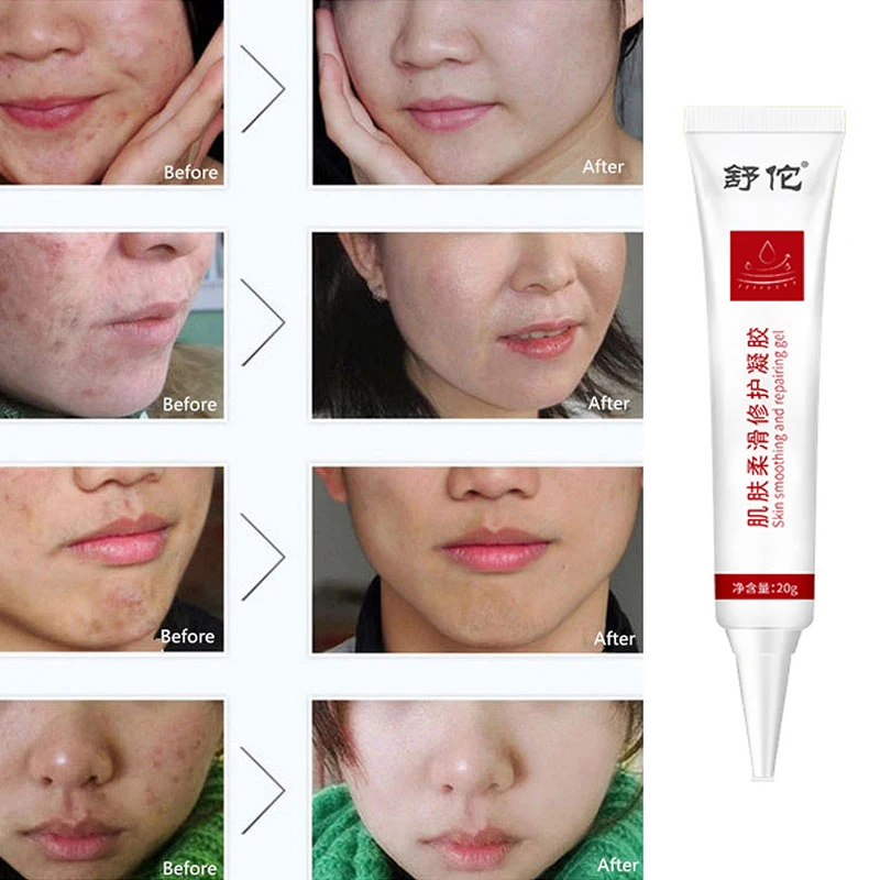 

Skin smoothing repair gel, lightening scars, scars, refreshing, moisturizing, moisturizing, repairing skin