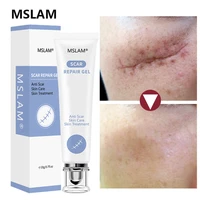 acne scar repair cream remove face pimples stretch marks gel repairing smoothing moisturizing surgical scar burn body skin care