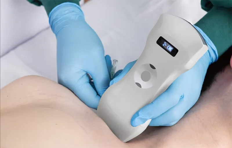 Sonostar портативный беспроводной ультразвуковой зонд цветной допплер 192E 3в1