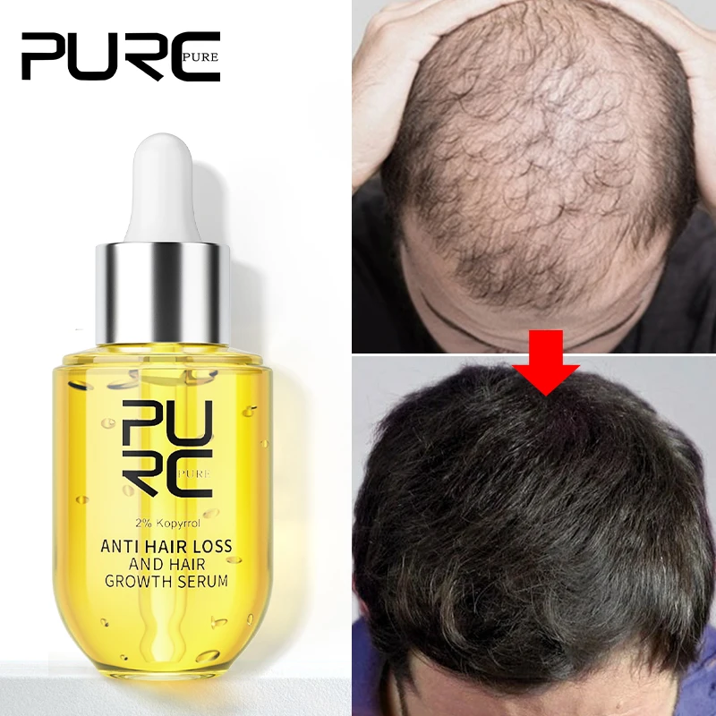 

Средство для быстрого роста волос PURC 2023 для мужчин и женщин, средство для ухода за волосами, Имбирь против выпадения кожи головы, необходимая сыворотка, товары для выращивания 50 мл
