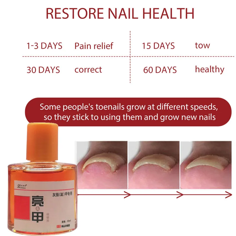 

25ml Feet Care Essence Anti Infection Paronychia Onychomycosis Repair Foot Liquid Toe Fungal Nail Treat Removal Nourish Dressing