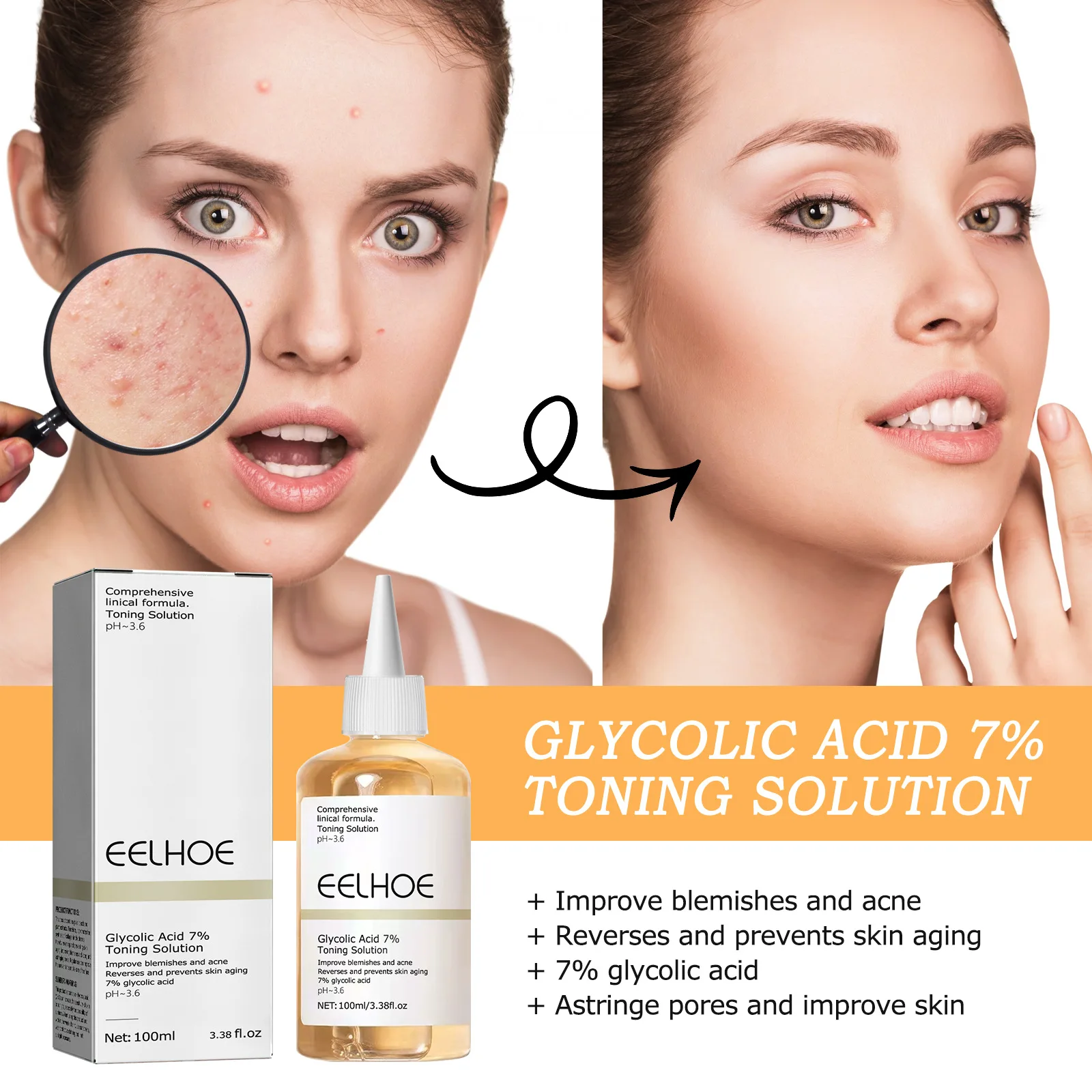 

Glycolic Acid 7% Toner Acne-removing Mouth-closing Moisturizing Shrinking Pores Brightening Complexion Essence Water