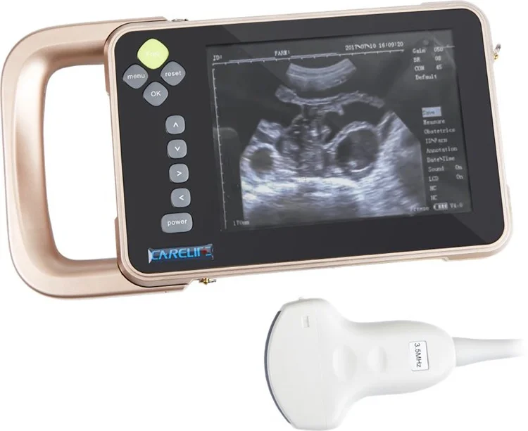 

S7 Cattle Sonar Scanner Veterinary Portable Uterus Scanner WATERPROOF SHEEP Pregnancy Tester Fetus PIG Animal Sonar