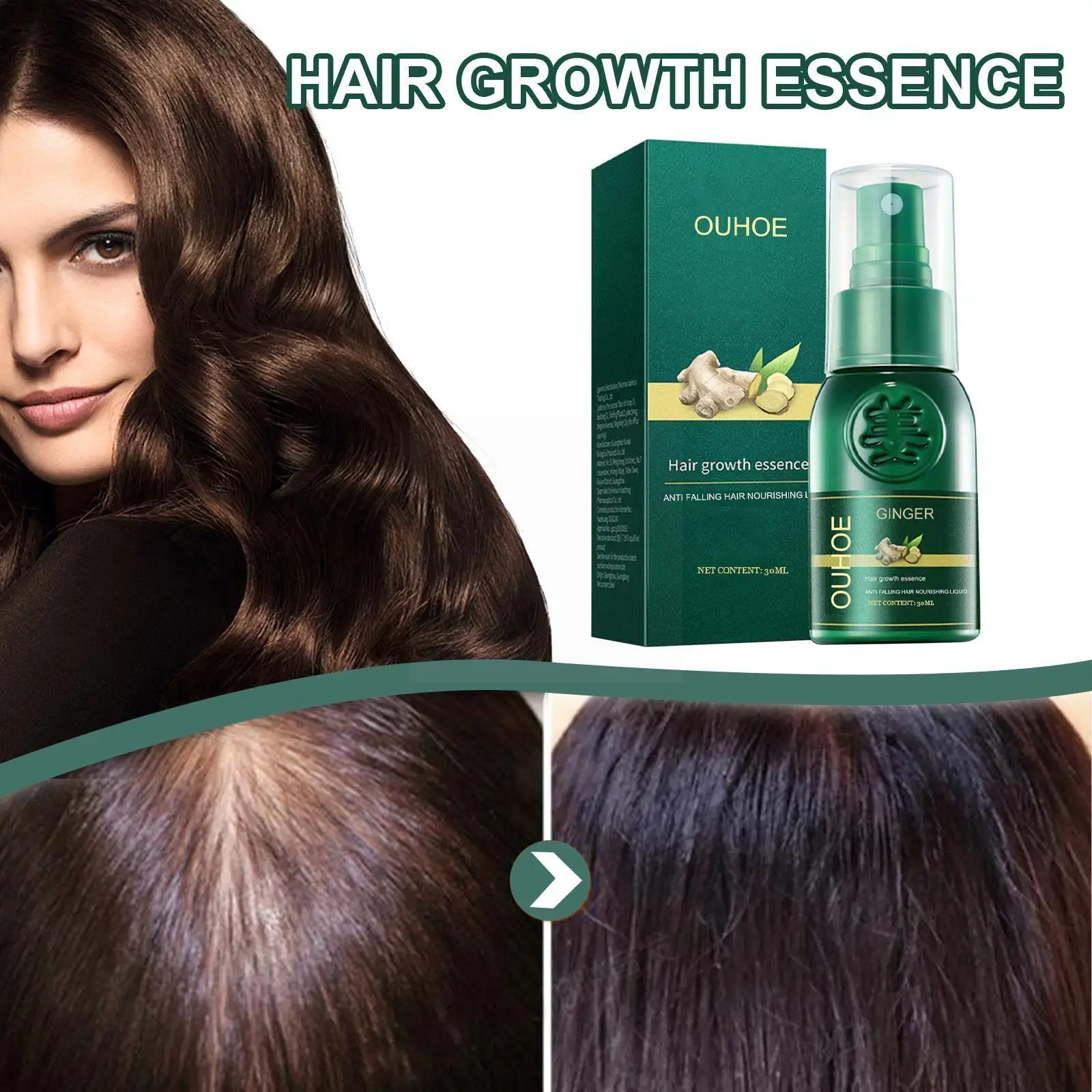 

Ginger Hair Growth Spray Ginger Extract Essence Spray Serum Loss Cream Growth Hair Nutrition Oil Damaged Essence Hair Anti- O1O6