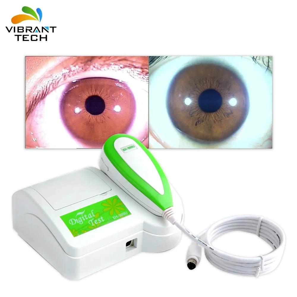 Фото Портативный медицинский прицел для глаз Iris Iriscope Iridology Camera Pro, программное обеспечение, быстрая доставка №2