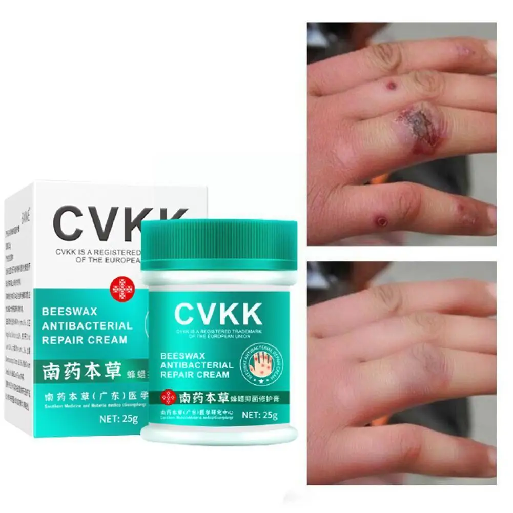 

25ml Anti-cracking Cream Snake Oil Ointment Rough Herbal Plaster Oil Cream Cracked Chapped Dry Pruritic Anti Frostbi J1x1