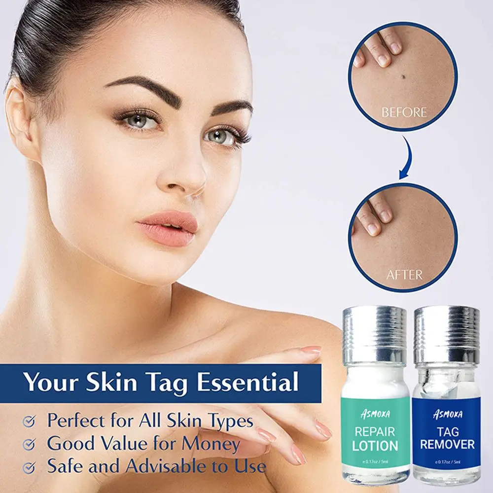 

Beauty & Health Skin Care Natural Painless Face Body Tag Remover Skin Tag Removal Wart Remover Mole Remover