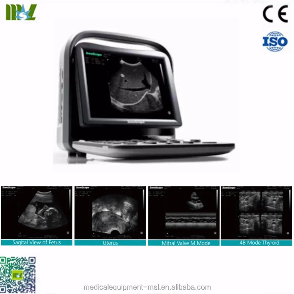 Запчасти для ультразвукового сканера Sonoscape A5