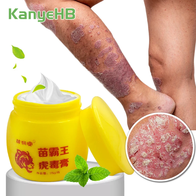 

1pcs Psoriasis Anti-itch Fungal Inhibition Cream Pityriasis Private Part Odor Tinea Cruris Dermatitis Ointment Eczema Cream S105
