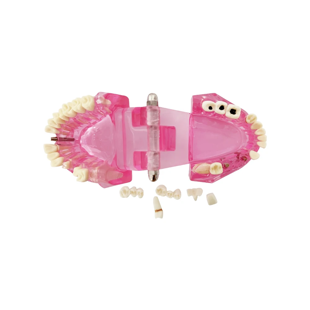 Модели зубов ремонтные модели из смолы для изучения и исследования медицины