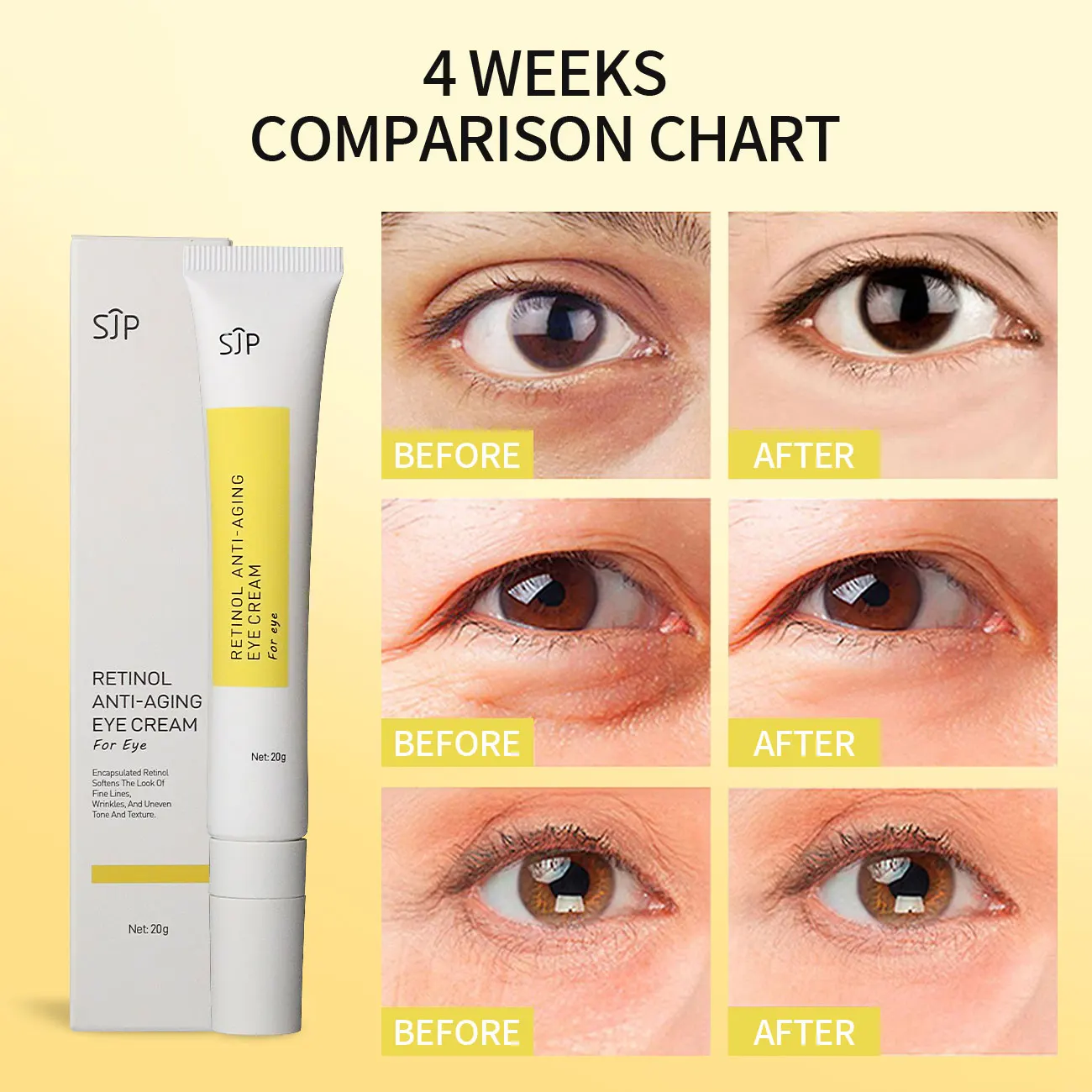 

Sjp Retinol Anti-aging Eye Cream 20g Anti-wrinkle Lifting Dark Circles Removal Lightening Whitening For Puffy Lines