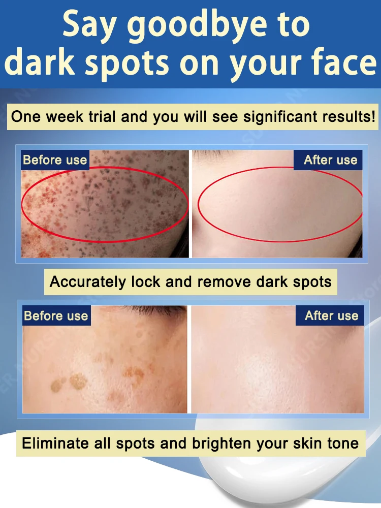 afe и быстрое удаление темных пятен