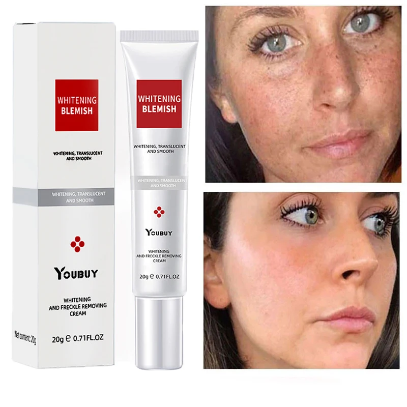 Dark Spots Remover Cream Whitening Skin Brightening Lighten Blemish Melanin Removal Melasma Moisturizing Anti Freckle Face Cream
