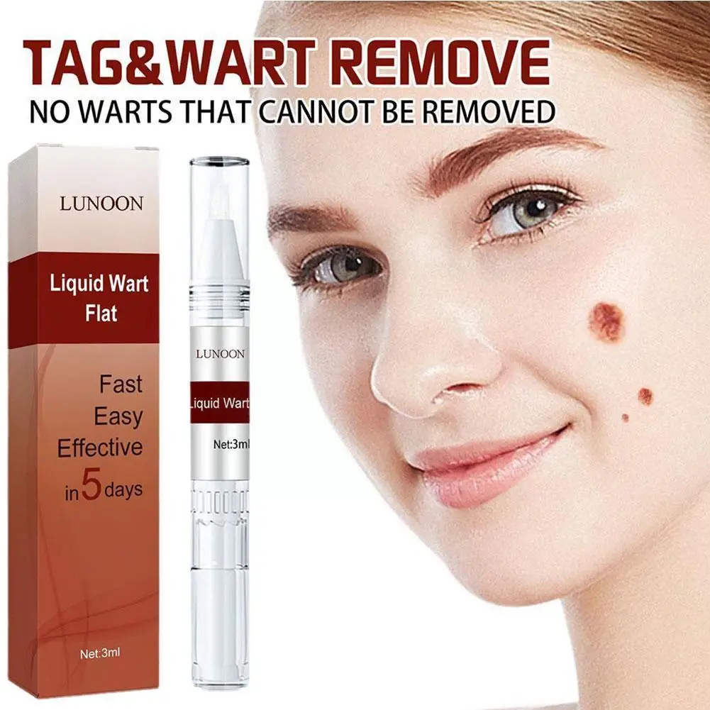

3ml Wipe Off Tags & Moles Pen For Callus Gram Warts Foot Remover Liquid Genital Wart Removal Treatment Pen Skin Beauty Q6B1