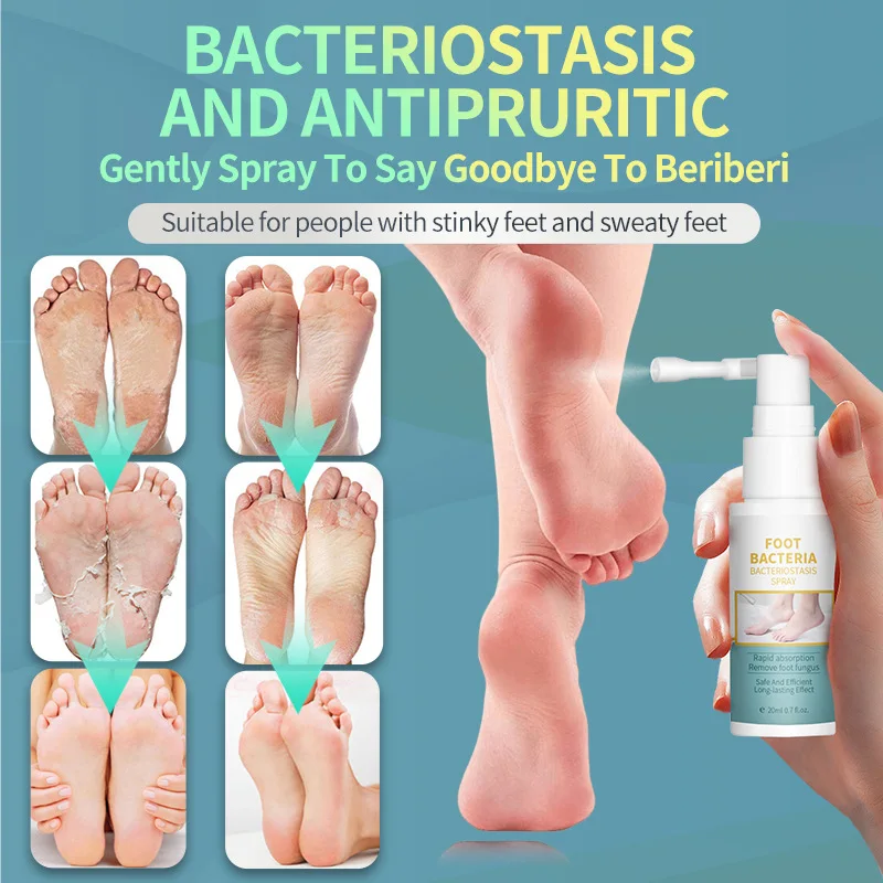 

Foot Bacteria Bacteriostasis Deodorant Spray Rapid Absorption Remove Foot Fungus