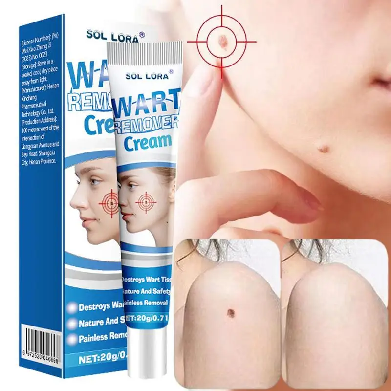 

1pcs Warts Remover Ointment Cream 20g Skin Tags Removal Gel Face Body Care Mole Remover Wart Removal Body Warts Treatments