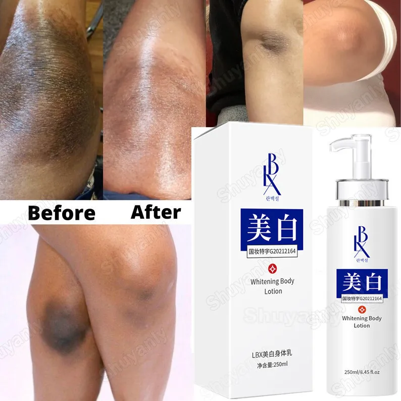 

Whitening Cream Bleaching Face Lightening Care Underarm Armpit Legs Knees Private Parts Body Moisturizing Dark Spot Brighten250g