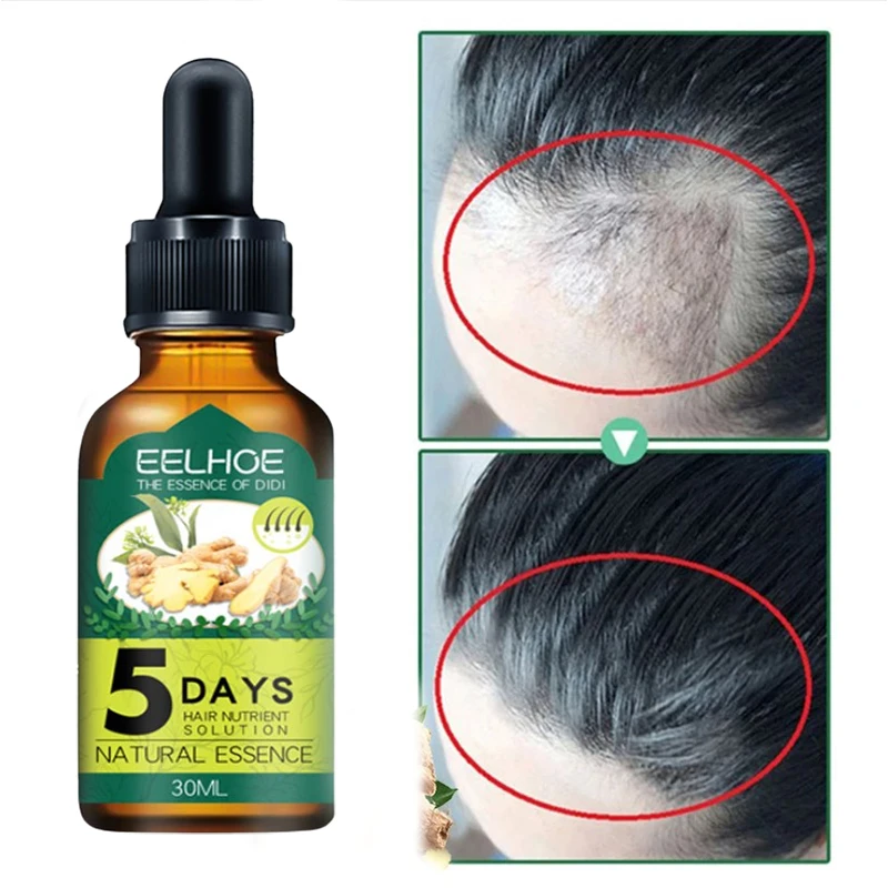 

5 Days Ginger Hair Growth Essential Oil Products Anti Hair Loss Serum Fast Growing Nourish Soften Scalp Repair Damaged Hair Care