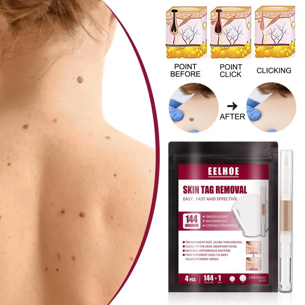 

Corn Removal Sticker Practical Fast Absorption Soft Skin Tag Wart Removing Paste for Female