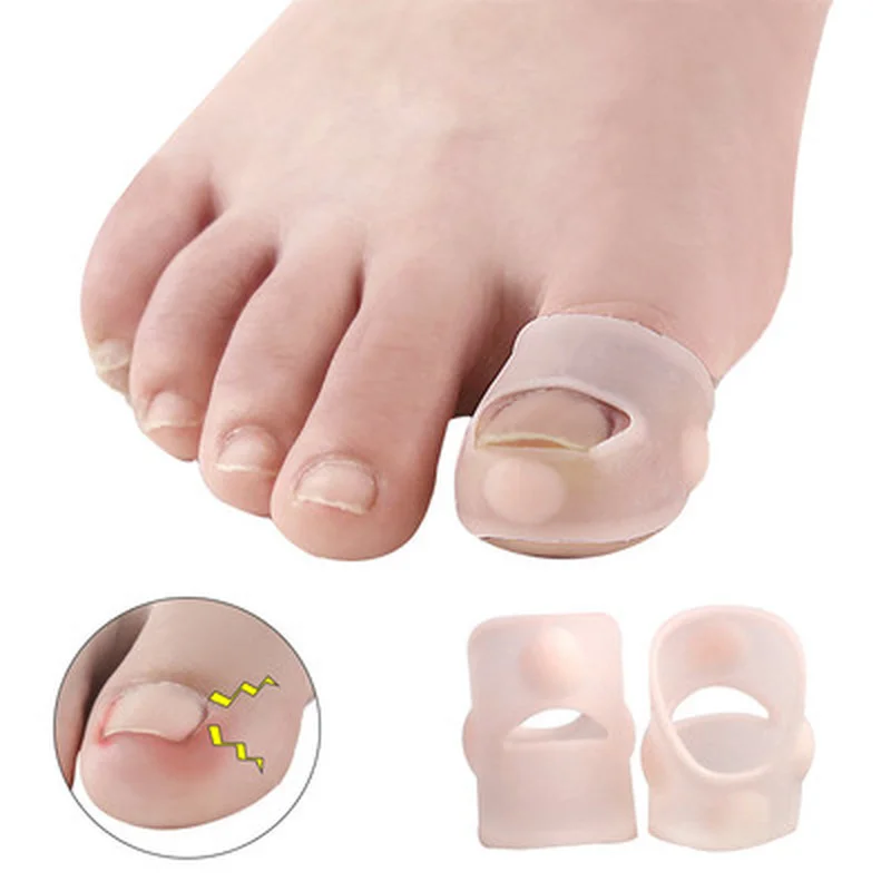 

2/4 Pairs Silicone Ingrown Toenail Correction Tool Invisible Ingrown Toe Nail Treatment Elastic Straightening Clip Brace Feet