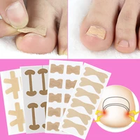 4 20pcs nail correction stickers ingrown toenail corrector patches paronychia treatment recover corrector fixer toe nail tools