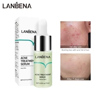 lanbena salicylic acid acne removal serum fade acne spots pimple anti acne oil control essence whitening moisturizing skin care