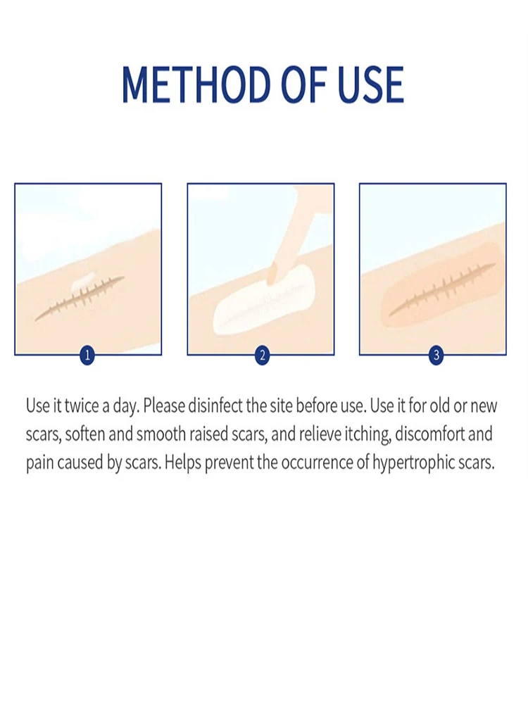 Келоидный крем