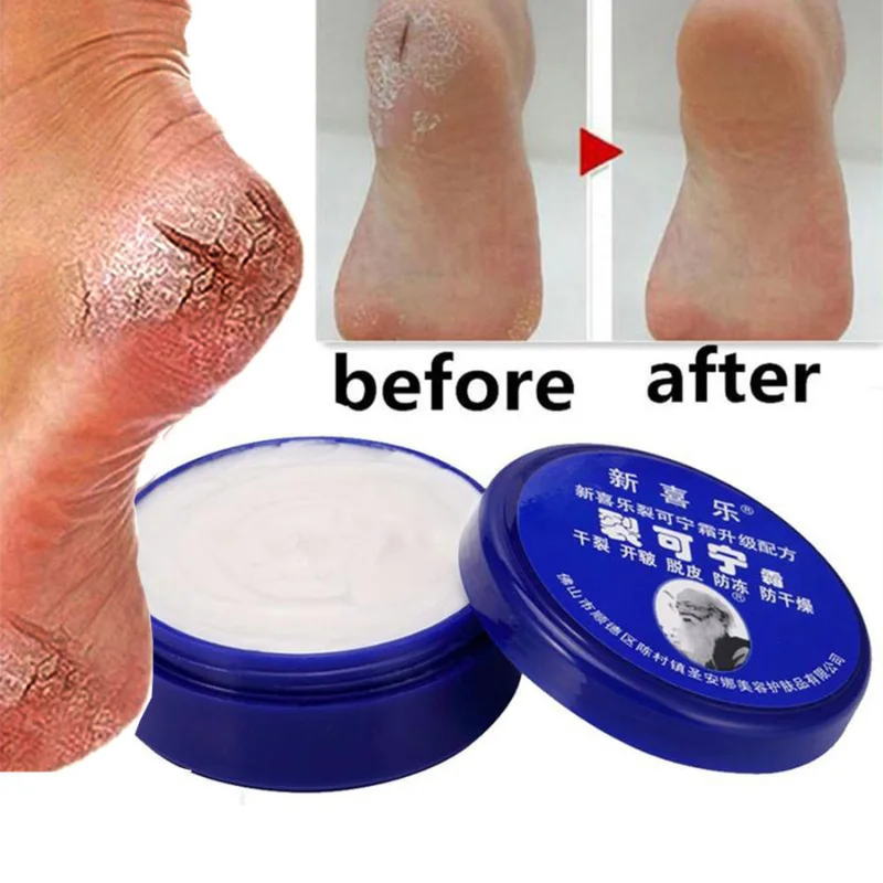 Oil Anti-drying Crack Feet Cream Heel Cracked Repair Cream R