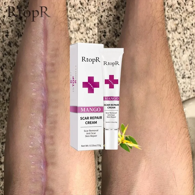 Крем для удаления шрамов с кожей Осветляющий от прыщей и черных точек |