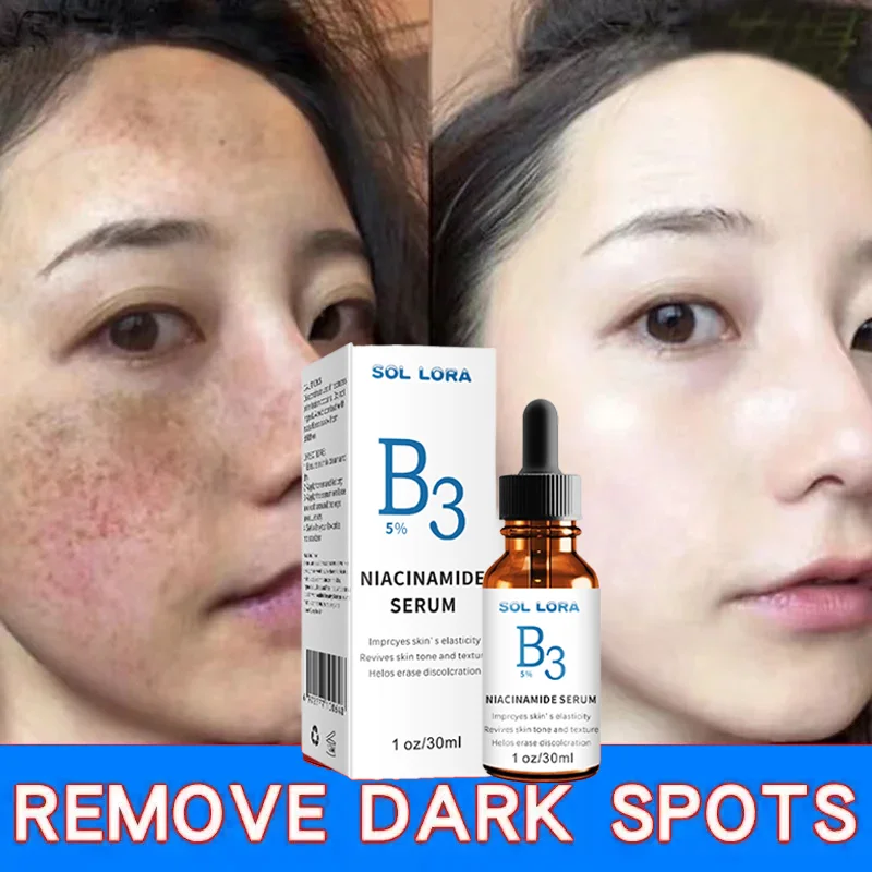 

Nicotinamide Whitening Face Serum Dark Spots Pigment Remover Lightening Essence Moisturizing Whitening Skin Care Women Products