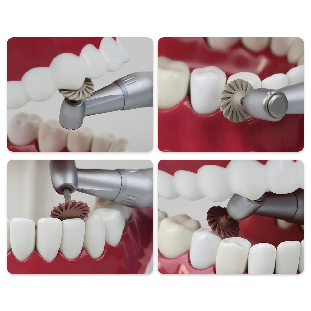 XYSZ 1 коробка стоматологический полировщик резины композитная смола полировка