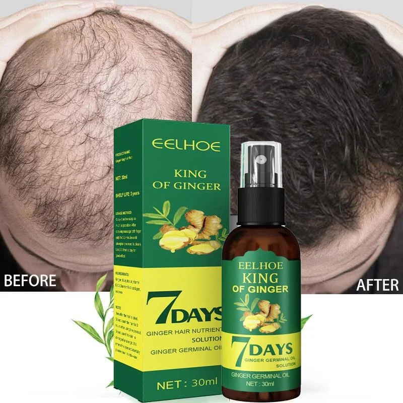 

7 Days Ginger Hair Growth Spray Anti Hair Loss Fast Growing Treatment Oil Prevent Dry Frizzy Damaged Thinning Repair Hair Care