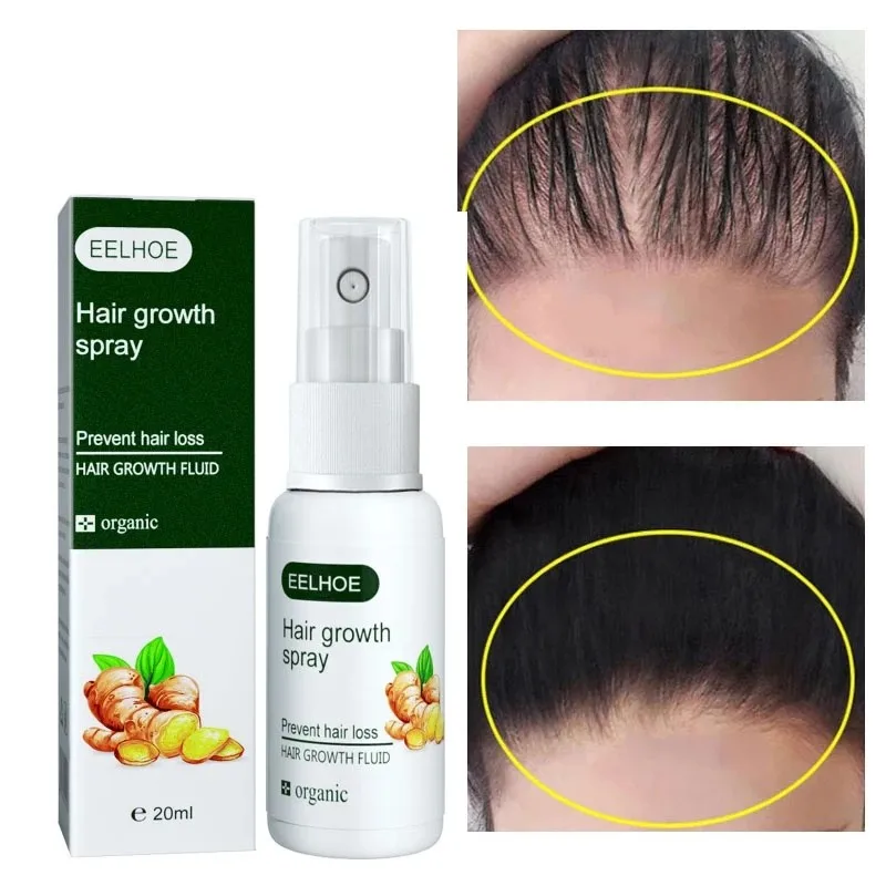 

Ginger Hair Growth Serum Spray Anti Hair Loss Fast Growing Smooth Repair Damaged Dry Frizzy Scalp Treatment Essence Oil Products