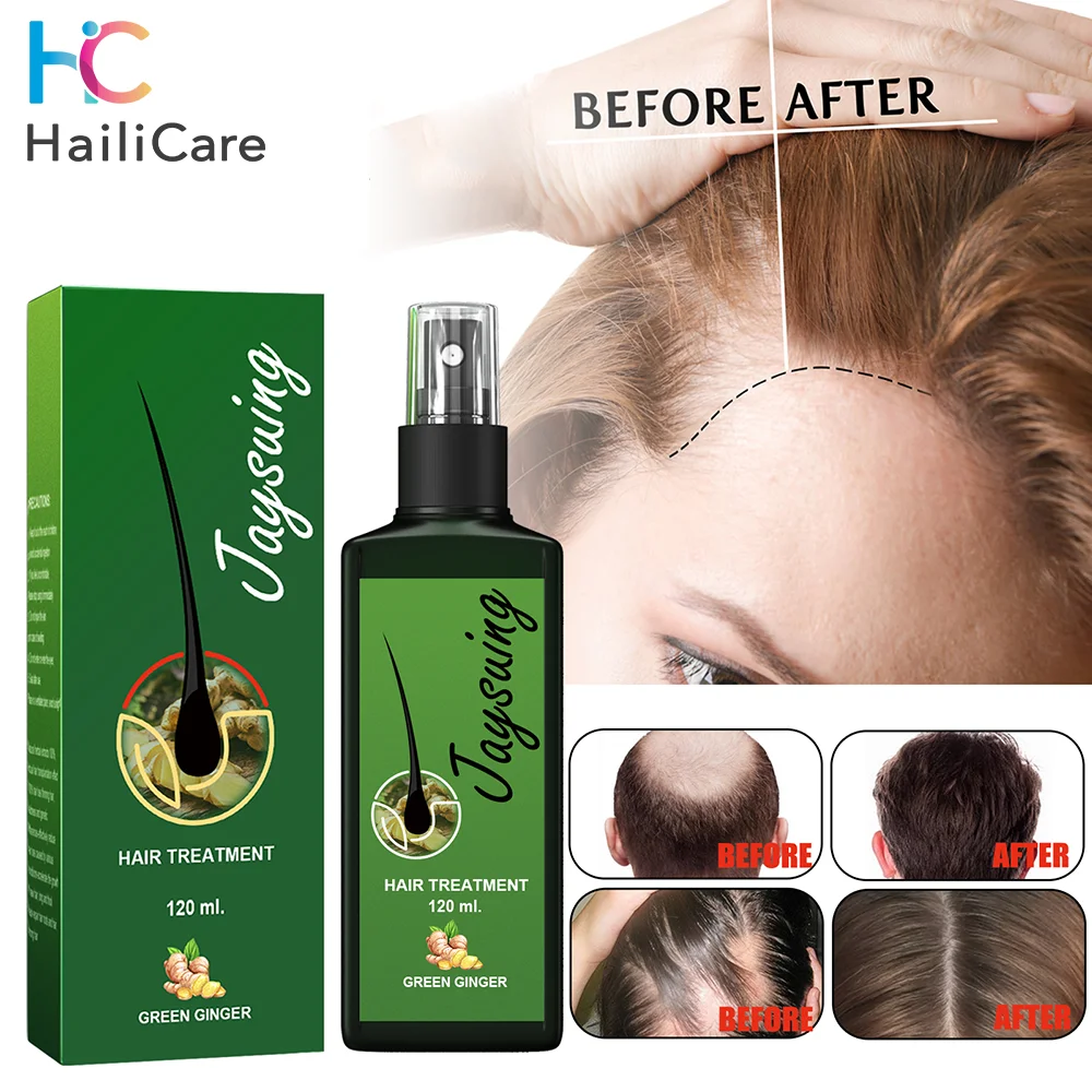 

120ml Hair Growth Spray Natural Ginger Hair Growth Oil Haircare Anti Hair Loss Hair Lotion Baldness Repair Spray For Hair Growth