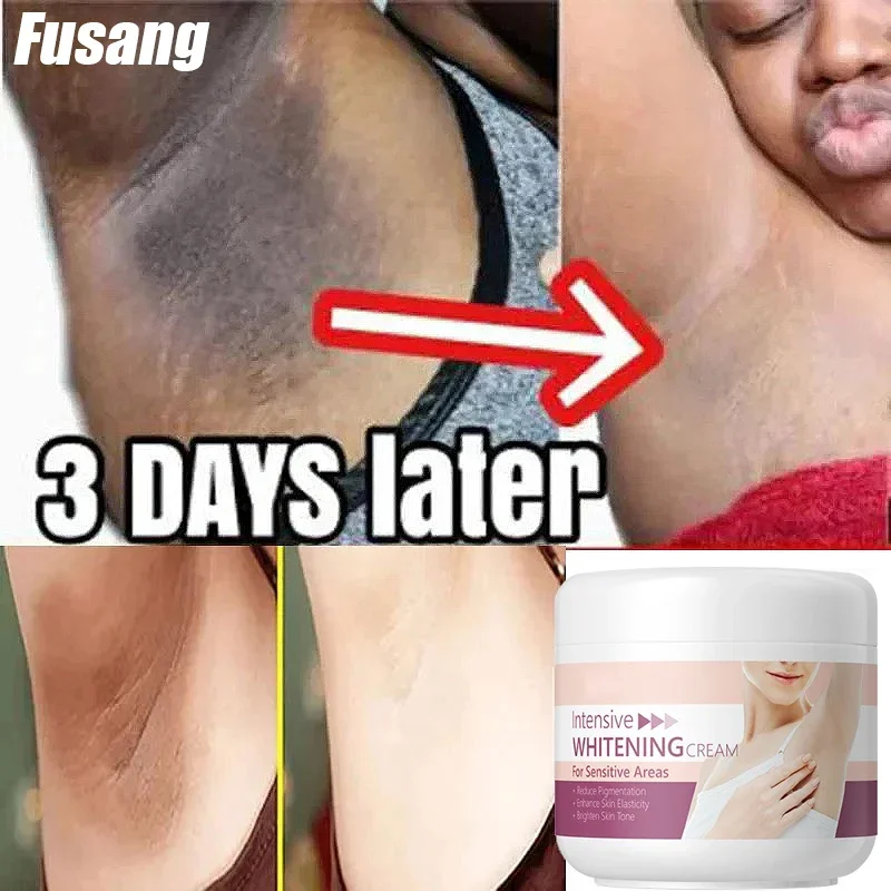 Крем для осветления внутренней части бедра женские суставы частные осветляющая