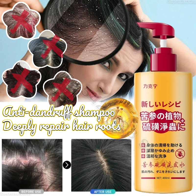 

Improve Itchy Scalp Relieve Rough Hair Sophora Flavescens Anti-mite Anti-dandruff Anti-itch Oil Control Sulfur Shampoo 400ml