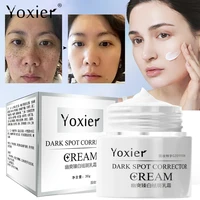 face cream moisturizing lighten pigmentation brighten skin colour remove dark spots chloasma age spots sunburn firming lift 30g
