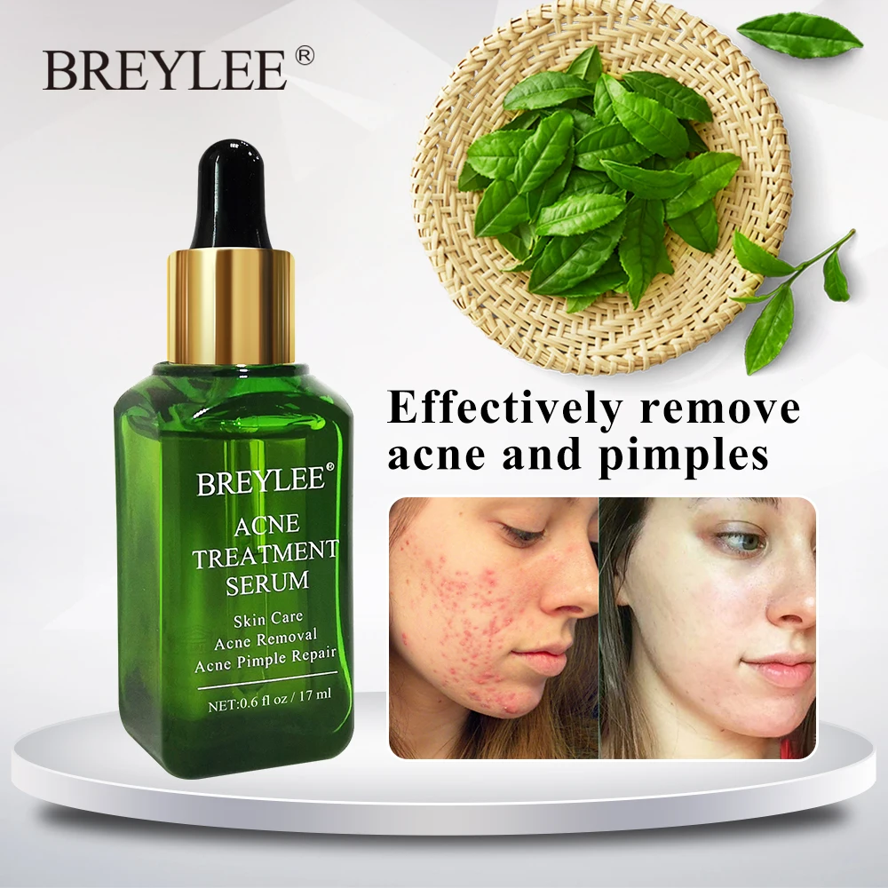 BREYLEE Tea Tree Acne Serum Essence Anti Acne Treatment Pimples Spot Remover Oil Control Liquid Whitening Moisturizing Skin Care