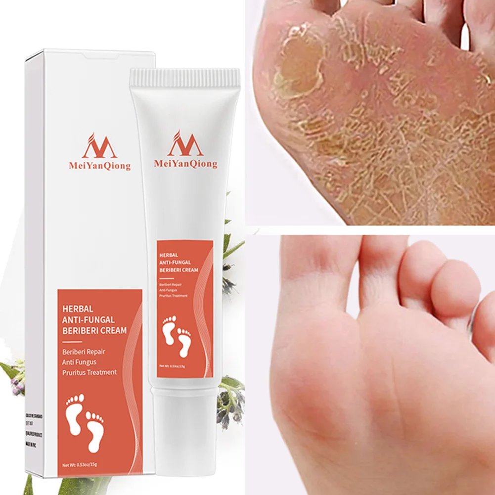 

Foot Care Skin Treatment Cream Anti-Fungal Natural Herbal Extract Athletes Foot Repair Cream Anti-Inflammatory, Itch Relief