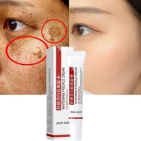 whitening freckle cream for skin lightening remove dark spots pimple acne treatment acne pimples oil control smooth skin care