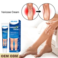 varicose veins relief cream varicose massage cream vasculitis phlebitis spider plaster body care healthy ointment legs massager