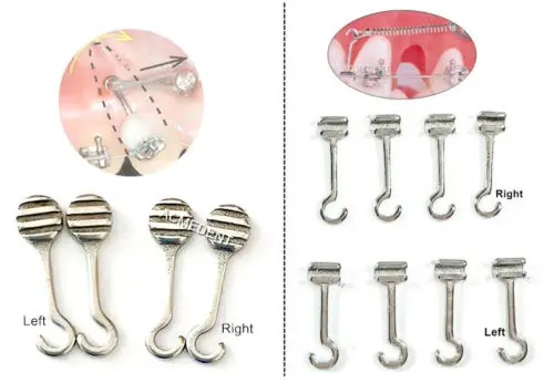 

10pcs Dental Orthodontic Crimpable Hook R/l Question Adhesive Hooks Bonding Brackets Wires Stainless Steel