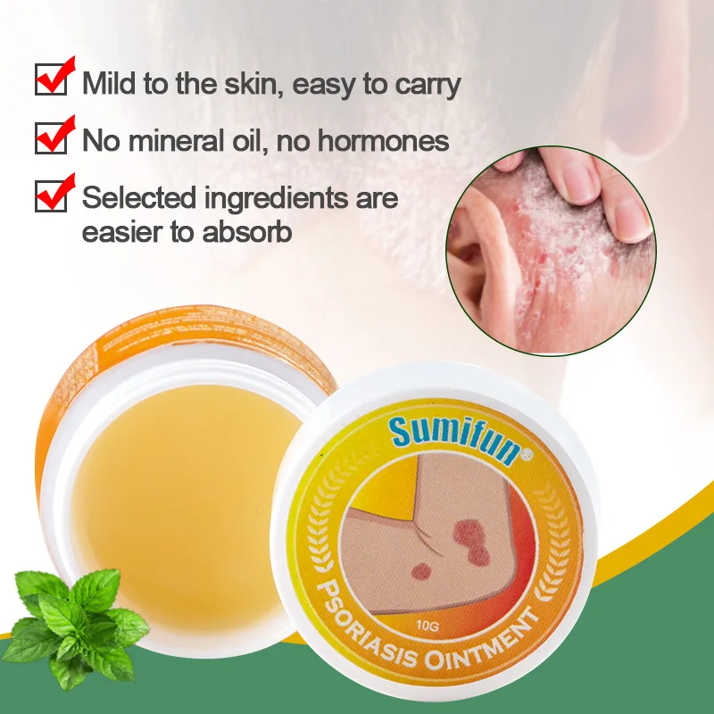 

Sumifun 10g Ringworm King hands and feet itchy inner thigh skin external cream K20004