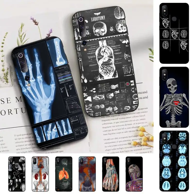 

Radiological Human Organs Skeleton Skull Phone Case for Xiaomi mi 5 6 8 9 10 lite pro SE Mix 2s 3 F1 Max2 3