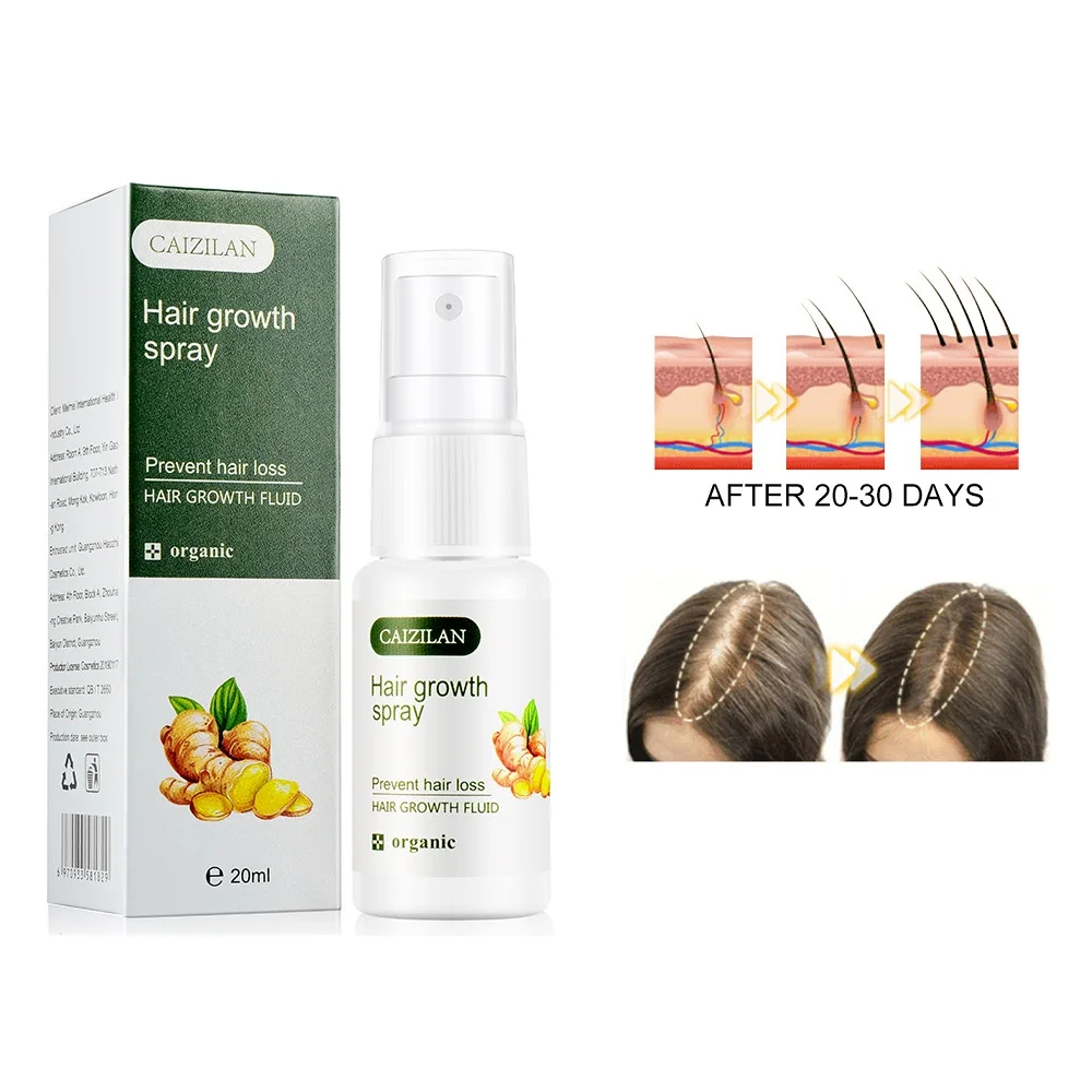 

20ml Ginger Hair Growth Spray Repair Serum For Anti Hair Loss Essential Oil Products Fast Treatment Prevent Hair Thinning Dry