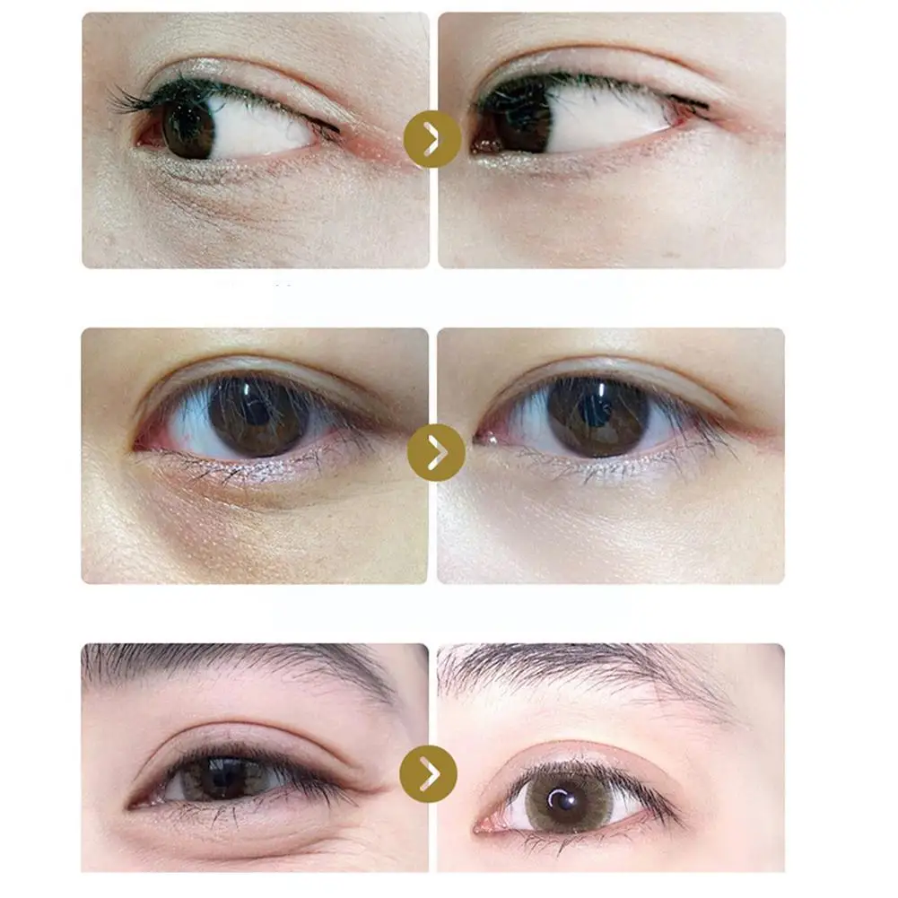 Рисунок 6 - Антивозрастная эссенция для кожи вокруг глаз