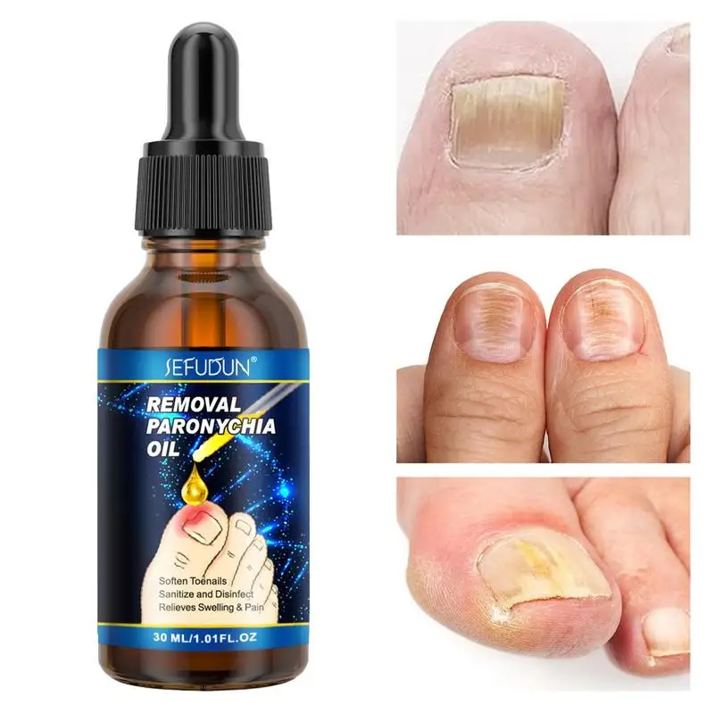 

Восстанавливающая эссенция для ногтей, восстановление ногтей, питательный натуральный эффективный гель для ногтей, уход за ногтями, безопасный раствор для ногтей для подростков